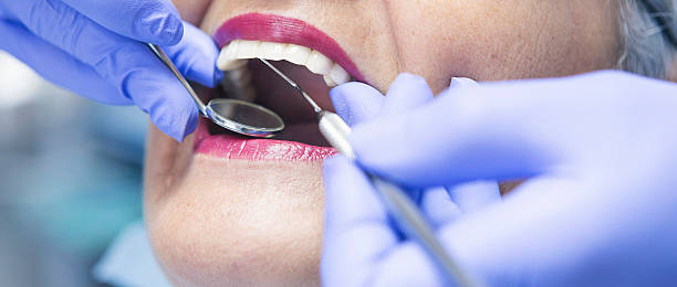 Best Emergency Dental Care for Broken or Chipped Teeth in Green Springs, OH